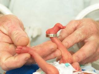 Novembro Roxo - Mês da Prematuridade - Destinado, especialmente para pais e mães de UTI neonatal
