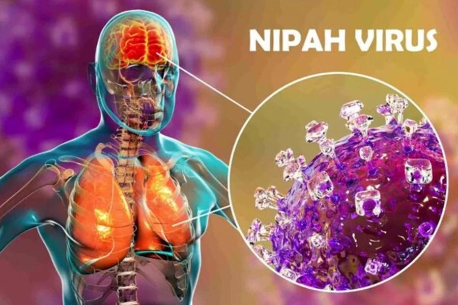Vírus Nipah será outra pandemia?